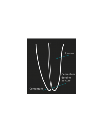 Endometr Locapex Five Ionyx