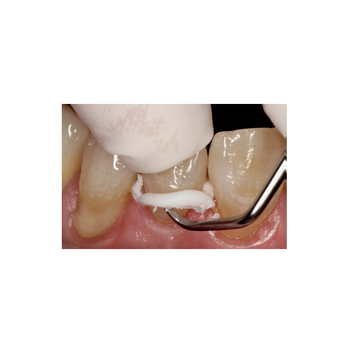 ZirCAD Cement Refill 8.5 g