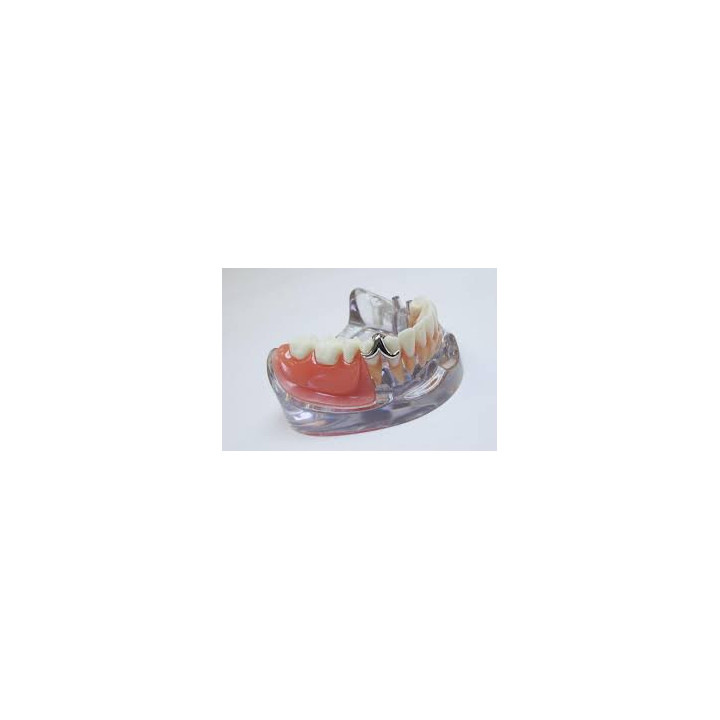 Villacryl H Plus 750g + 400ml