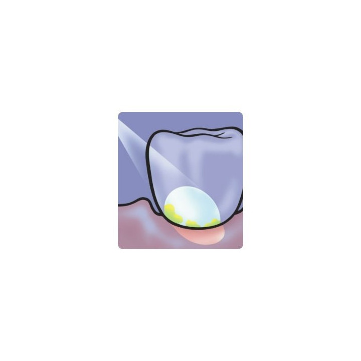 Plaque Test 10ml